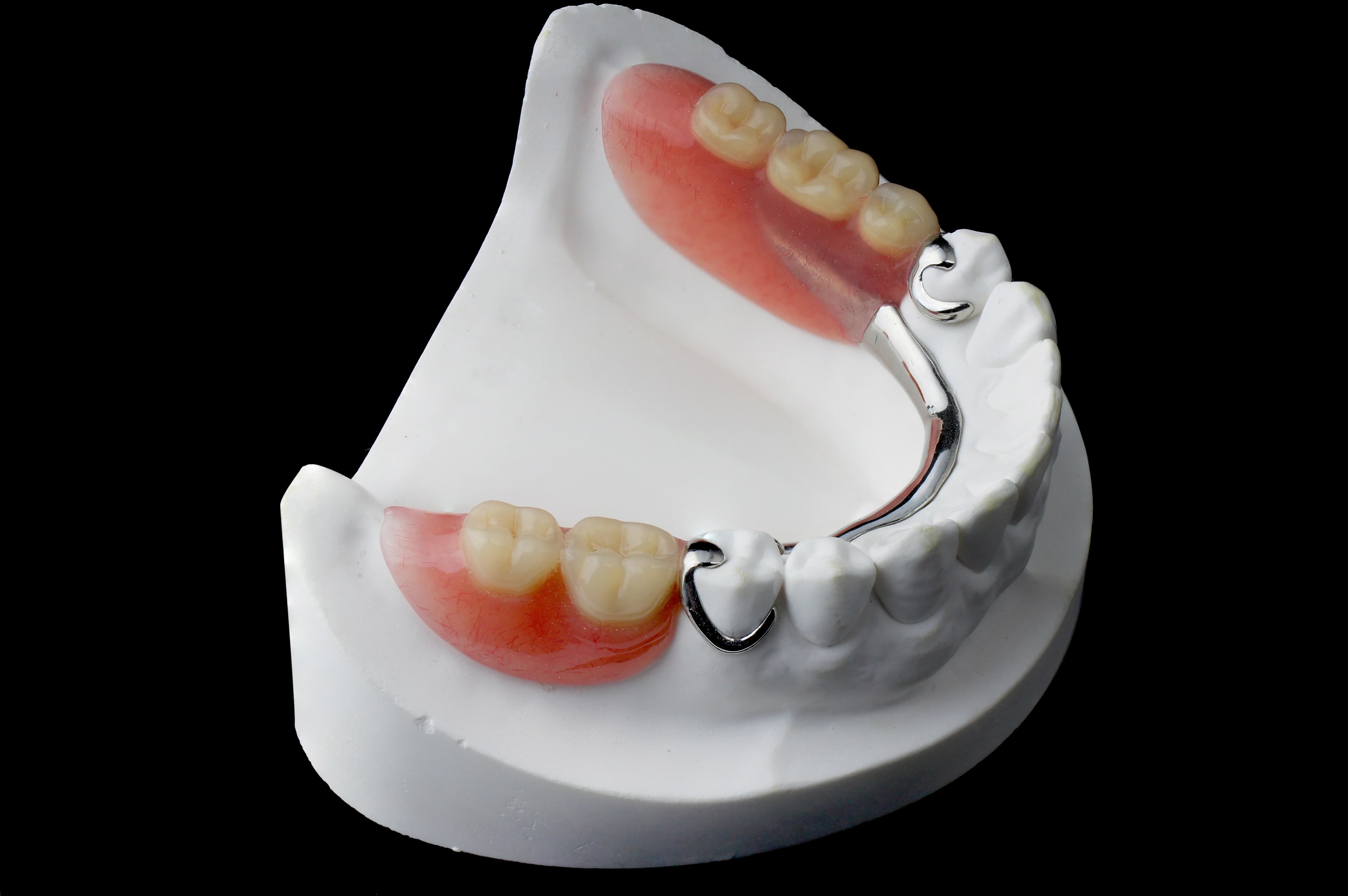 Full Mouth Rehabilitation